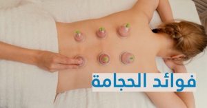 فوائد الحجامة